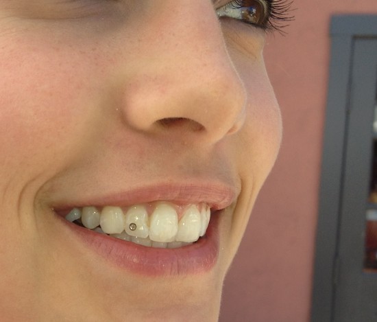 tooth jewelry